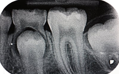 Diagnostik - R�ntgen