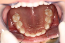 Leistungsspektrum - F�llungen