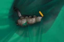 Leistungsspektrum - Kofferdam Z�hne